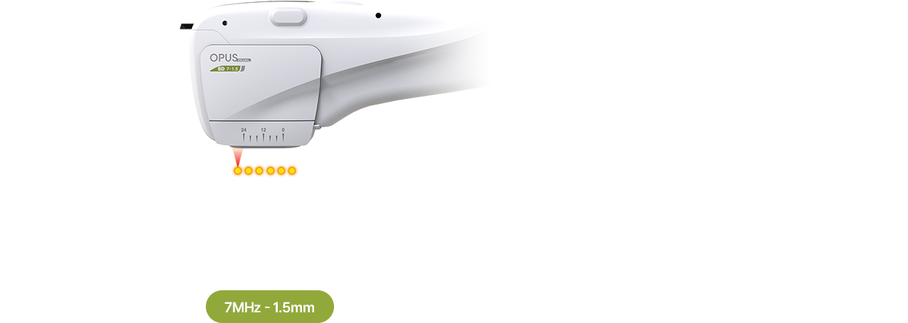 카트리지 1.5mm