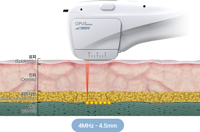 카트리지 4.5mm